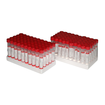 наборы собрания пробирки VTM 3ml Poweray носовые с пробирками PCR Dacron